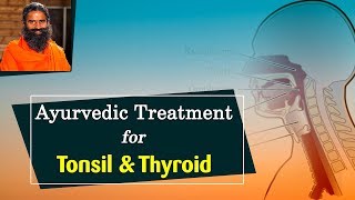 Ayurvedic Treatment for Tonsil amp Thyroid  Swami Ramdev [upl. by Ynttirb771]