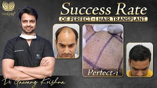 Success Rate of Perfecti Hair Transplant Technique  Best Hair Transplant in India  Medlinks [upl. by Alessandra]