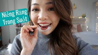 Trải Nghiệm Niềng Răng Trong Suốt ♡ My Invisalign Experience ♡ TrinhPham [upl. by Ressan]