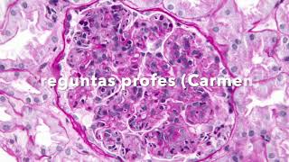 Caso Clínico Glomerulonefritis 4112024 MEDUVSF [upl. by Barkley444]