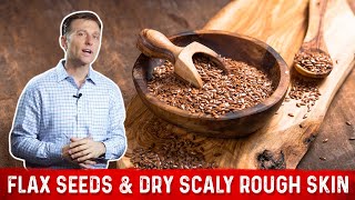 Flaxseed Benefits for Skin amp Symptoms of Linoleic Acid Deficiency – Dr Berg [upl. by Buckden]