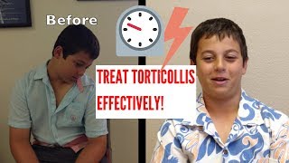 Effective Torticollis Treatment INCREDIBLE RESULTS [upl. by Ydnem]