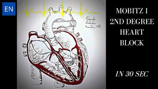 Mobitz I 2nd Degree Heart Block Animation and ECG Shorts [upl. by Trotta]