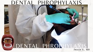 Dental Hygienist Performs a Prophylaxis  RDH in ATL Vlog [upl. by Pasahow554]