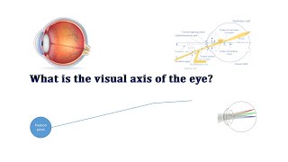 Visual Axis [upl. by Kiley]