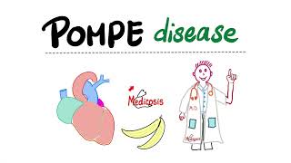 Pompe Disease with a mnemonic  Glycogen Storage Diseases [upl. by Lawley]