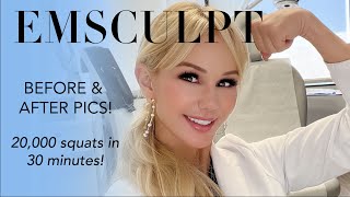 Sculpt amp tone your body with EMSCULPT BEFORE amp AFTER PICS How it works are you sore after [upl. by Notsnorb]