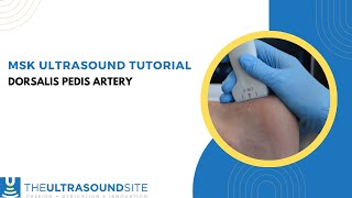 How to find the Dorsalis Pedis artery on MSK ultrasound of the foot [upl. by Rondon]