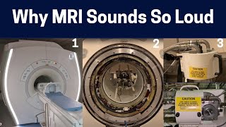 What Makes The Different MRI Scan Sounds Knocking to Rhythmic Chirping MRI Sounds Explained [upl. by Eisaj]