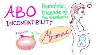 ABO incompatibility mnemonic [upl. by Notlim]