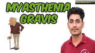 MYASTHENIA GRAVIS  SIGN AND SYMPTOM  MANAGEMENT [upl. by Hannazus]