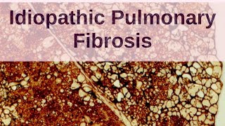 What is Idiopathic Pulmonary Fibrosis  Pathology mini tutorials [upl. by Tacita913]