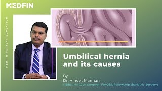 What You Need to Know About Umbilical Hernia Causes and Symptoms [upl. by Wake]