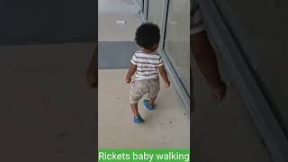 Rickets baby walking [upl. by Dadirac91]