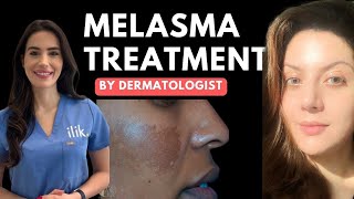 Dermatologist approved routine for Melasma  How to use hydroquinone [upl. by Othilia]