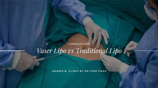 Vaser Lipo vs Traditional Lipo  Amaris B Clinic by Dr Ivan Puah [upl. by Darnall]