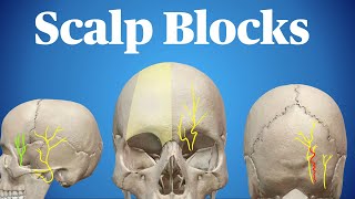 Scalp Blocks [upl. by Fairfield]