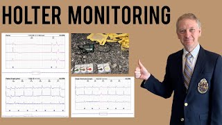 Holter Monitor  Everything you need to know [upl. by Rame]