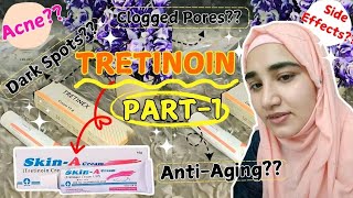 My Skincare Journey using TRETINOIN 😍  3 Year Tretinoin Transformation [upl. by Reviel]