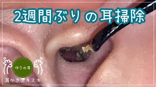 【耳かき】2週間ぶりの耳掃除【ear cleaning】 [upl. by Aical931]