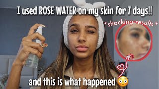 Unexpected reaction after I used ROSE WATER on my face for a week [upl. by Attolrahc148]