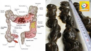 Une boisson incroyable pour vider votre colon et dégonfler le ventre  Random888 [upl. by Allesig266]