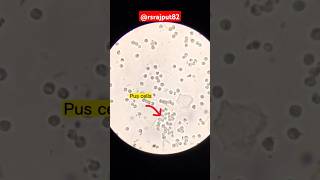 Urine of microscope exam 🔬 shorts [upl. by Milka]