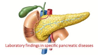 Laboratory findings in specific pancreatic diseases [upl. by Isac68]