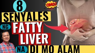 8 Senyales ng Fatty Liver na Di Mo Alam  by Doc Willie Ong [upl. by Dylane237]