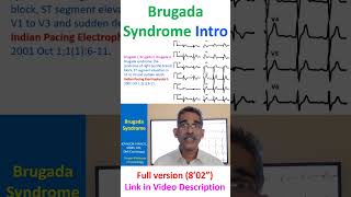 Brugada Syndrome [upl. by Annoerb]