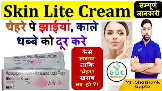 Skin Lite Cream की सम्पूर्ण जानकारी  चेहरे पे झाईयां काले धब्बे को दूर करे लगाने का सही तरीका🙌💊👌👍 [upl. by Vere]