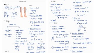 VARICOSE VEINS NOTES  GENERAL SURGERY ONE PAGE NOTES  SURGERY  4TH PROFF  MBBS [upl. by Gladwin177]