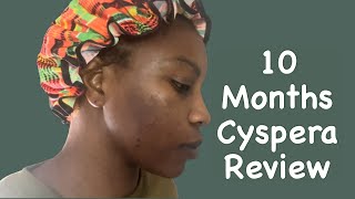 Cyspera Before And After 10 Months Review Answering Questions [upl. by Aenil]