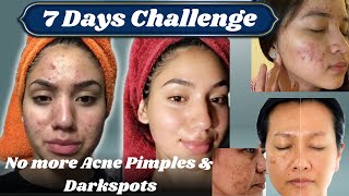 Home remedy to remove Dark Spots  7 days challenge⏳ Scar Treatment  Glam Bar by Fatima [upl. by Dorkus20]