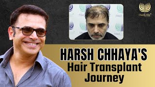 Harsh Chhayas Hair Transplant Journey  Celebrity Hair Transplant  Medlinks [upl. by Acired241]