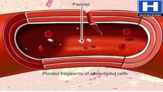 Blood clotting process hemostasis in 3D animation  Blood physiology [upl. by Ille]