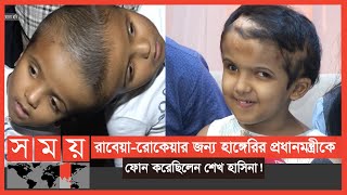 ৪৮ বার অপারেশন শেষে বাড়ি গেলো জোড়ামাথার রাবেয়ারোকেয়া   Conjoined Twins  Somoy TV [upl. by Daniyal]