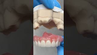 Fitting in the missing Anteriors ​⁠EnvisiontecMain envisiontec lsk121shorts dentist [upl. by Ling]