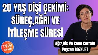 20 Yaş Dişi Çekimi Süreç Ağrı ve İyileşme Süresi [upl. by Yznyl]