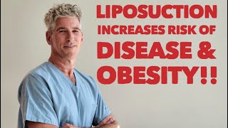 Liposuction Risk of Both Disease amp Obesity by Removing Beneficial Adiponectin Producing Good Fat [upl. by Ashlan]