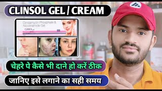 Clinsol gel how to use full review in hindi [upl. by Dnalwor]