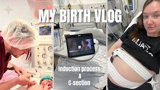 MY BIRTH VLOG amp STORY  Induction amp Csection [upl. by Ylimme317]