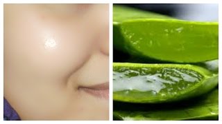 How to get clear glowing spotless skin by using aloe Vera gel [upl. by Marielle]