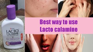 Lecto Calamine Lotion UsesBest 5 Way to Use On SkinNo More Dry pigmentedItcy Skin [upl. by Nivonod]