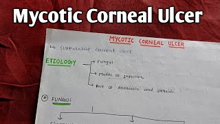 MYCOTIC CORNEAL ULCER  A K KHURANA  OPHTHAL [upl. by Yrneh314]