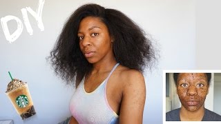 DIY Coffee Scrub How To Get Rid Of Acne Hyperpigmentation amp Cellulite [upl. by Leanna]