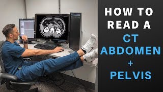 Radiology How to Read a CT Abdomen amp Pelvis My search pattern [upl. by Suissac]