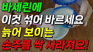 바세린에 이것 섞어 바르면 늙어 보이는 손 주름 사라지고 탱탱해져요 손 주름 없애는 법 입가 주름 없애는 방법 바세린 효능 [upl. by Leila]