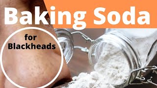 Baking Soda for Blackheads  Will Baking Soda Remove Blackheads on Your Nose [upl. by Kilian775]