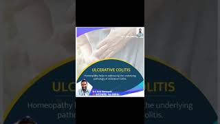 Ulcerative colitis treatment [upl. by Annohsal]